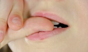 ADHD and Skin Picking